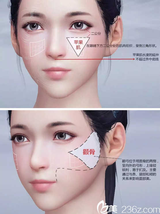 蘋果肌和高顴骨的區(qū)別圖
