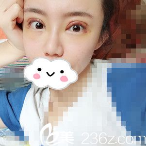 術(shù)后第三天