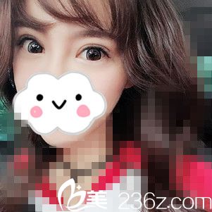 術(shù)后第15天的我