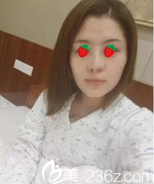 剛做完鼻綜合手術(shù) 剛做完鼻綜合手術(shù)