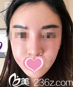 做完手術(shù)術(shù)后天