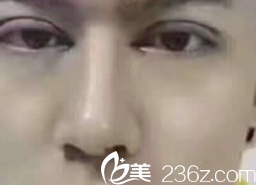 汝森楊子偉雙眼皮天 汝森楊子偉雙眼皮天