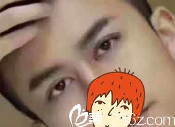 大家覺得我找包頭汝森楊子偉做切開法雙眼皮一個月后還會為找不到女票發(fā)愁嗎