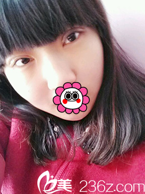 術(shù)后7天眼睛拆線后的樣子 術(shù)后7天眼睛拆線后的樣子