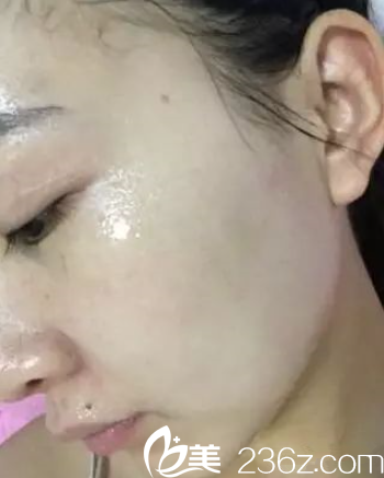 敷補(bǔ)水面膜 敷補(bǔ)水面膜