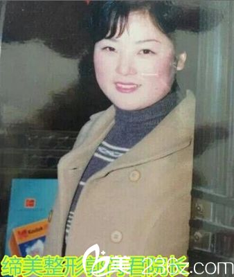 締萊美整形院長郭芮君18歲照 締萊美整形院長郭芮君18歲照