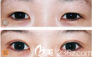 北京美萊醫(yī)療美容醫(yī)院案例 北京美萊醫(yī)療美容醫(yī)院案例