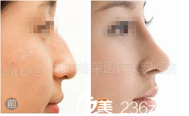 北京美萊醫(yī)療美容醫(yī)院案例 北京美萊醫(yī)療美容醫(yī)院案例