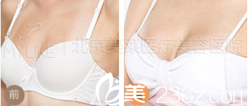 北京美萊醫(yī)療美容醫(yī)院案例 北京美萊醫(yī)療美容醫(yī)院案例