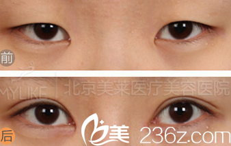 北京美萊醫(yī)療美容醫(yī)院案例 北京美萊醫(yī)療美容醫(yī)院案例