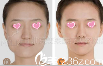 北京美萊醫(yī)療美容醫(yī)院案例 北京美萊醫(yī)療美容醫(yī)院案例