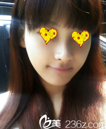 術(shù)后 術(shù)后