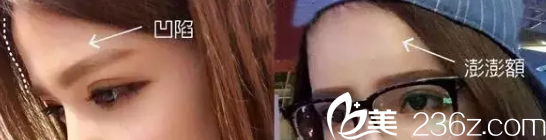 陳宏榮整形怎么樣？看微整形效果圖