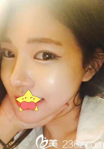 快一個(gè)月咯