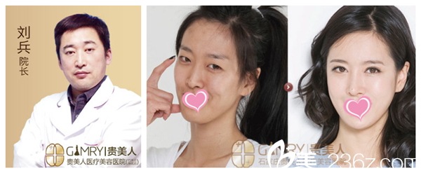 石家莊貴美人整形醫(yī)院院長劉兵 石家莊貴美人整形醫(yī)院院長劉兵