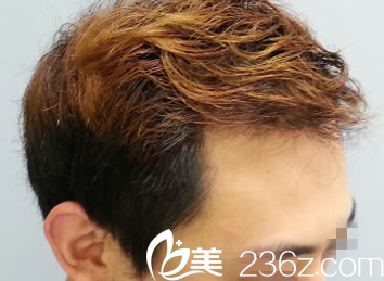 術(shù)后八個月恢復(fù)情況 術(shù)后八個月恢復(fù)情況