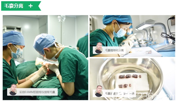 采用06mm的提取儀進(jìn)行毛囊提取