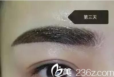 紋繡第三天效果 紋繡第三天效果