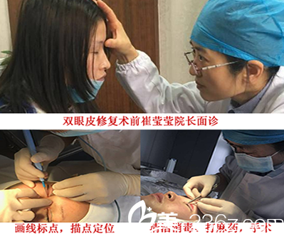 安徽合肥崔勁松崔向葵院長面診及雙眼皮失敗修復手術過程 安徽合肥崔勁松崔向葵院長面診及雙眼皮失敗修復手術過程