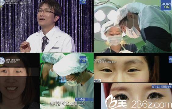 江南首延整形外科崔東一出演Let me in 4