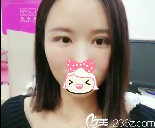 術(shù)后第28天 術(shù)后第28天