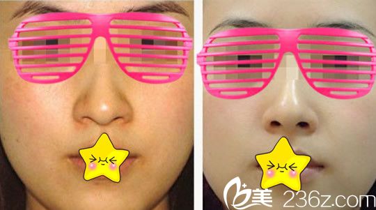 蘭州明倫整形美容案例 蘭州明倫整形美容案例