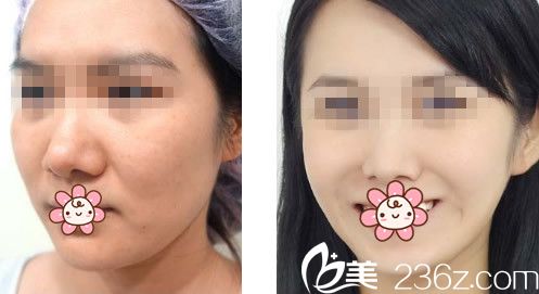 蘭州明倫整形效果