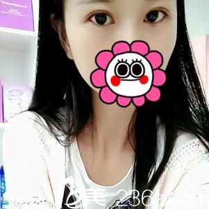 術(shù)后14天效果