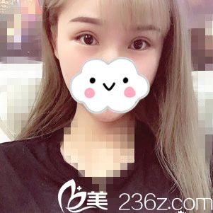 手術(shù)后半個(gè)月