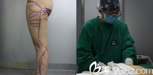 西安高一生醫(yī)療美容醫(yī)院王恒術(shù)前照片1