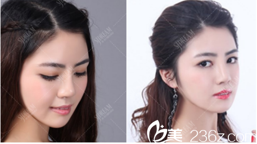 術(shù)后美麗的樣子