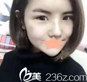 術(shù)后真的是美美噠的 術(shù)后真的是美美噠的