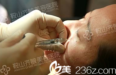 開始豐淚溝 開始豐淚溝