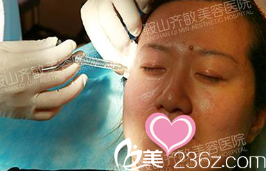 玻尿酸豐太陽穴 玻尿酸豐太陽穴