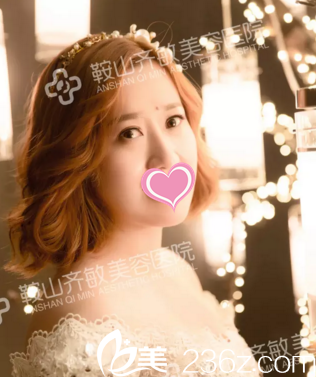 在鞍山整形醫(yī)院做完玻尿酸填充面部后，我成功蛻變成美麗新娘