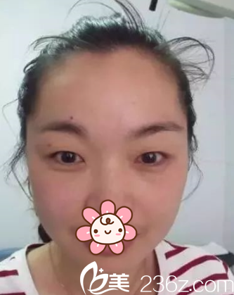 去新疆伊麗莎白整形醫(yī)院前 去新疆伊麗莎白整形醫(yī)院前