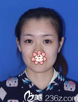 這是瑪麗亞醫(yī)生讓我拍的術(shù)前照 這是瑪麗亞醫(yī)生讓我拍的術(shù)前照