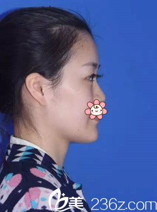 側(cè)面樣子 側(cè)面樣子