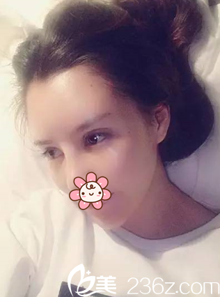 術(shù)后第二天 術(shù)后第二天