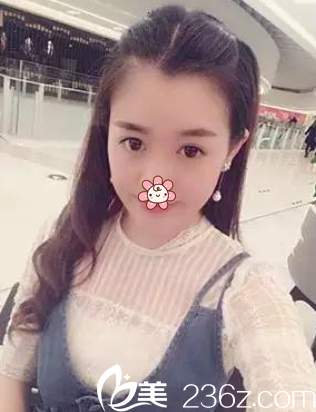 術(shù)后快一個月時候 術(shù)后快一個月時候