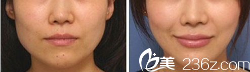 北京印正山醫(yī)療美容診所案例 北京印正山醫(yī)療美容診所案例