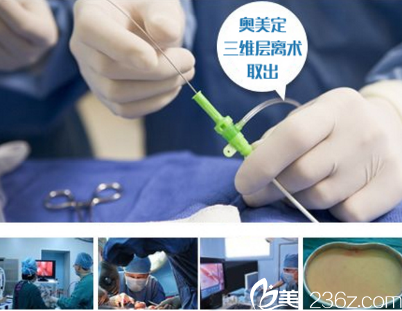 三維層次分離取奧技術(shù)