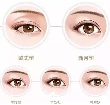 四平王清純整形醫(yī)院怎么樣？雙眼皮手術(shù)9800元起塑造美眼
