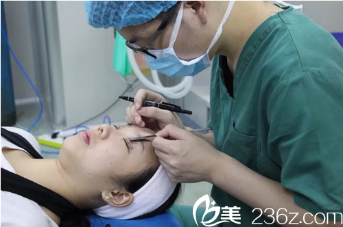 揭陽華美整形醫(yī)院張旭雙眼皮術(shù)前畫線 揭陽華美整形醫(yī)院張旭雙眼皮術(shù)前畫線