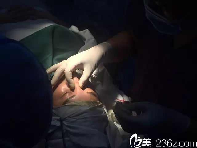 膨體假體植入術(shù)進(jìn)行