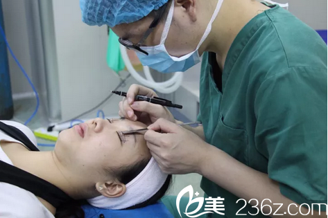 張旭醫(yī)生為我做雙眼皮術前畫線