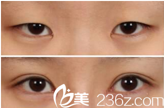 北京清木醫(yī)療美容診所案例 北京清木醫(yī)療美容診所案例