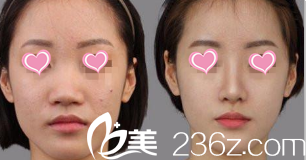 北京清木醫(yī)療美容診所案例 北京清木醫(yī)療美容診所案例