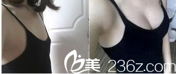 北京清木醫(yī)療美容診所案例 北京清木醫(yī)療美容診所案例