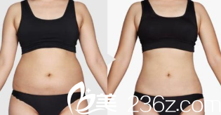 北京清木醫(yī)療美容診所案例 北京清木醫(yī)療美容診所案例